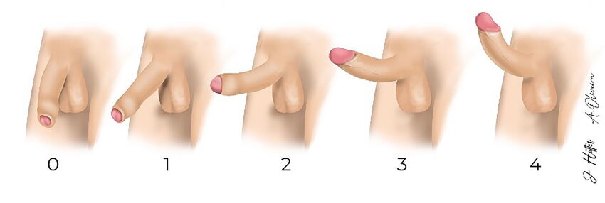 rate your cock i was a 4 now i'm a 0 aiming for at least 3 soon