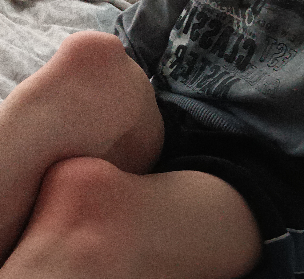what do [s4s] boy knees look like?