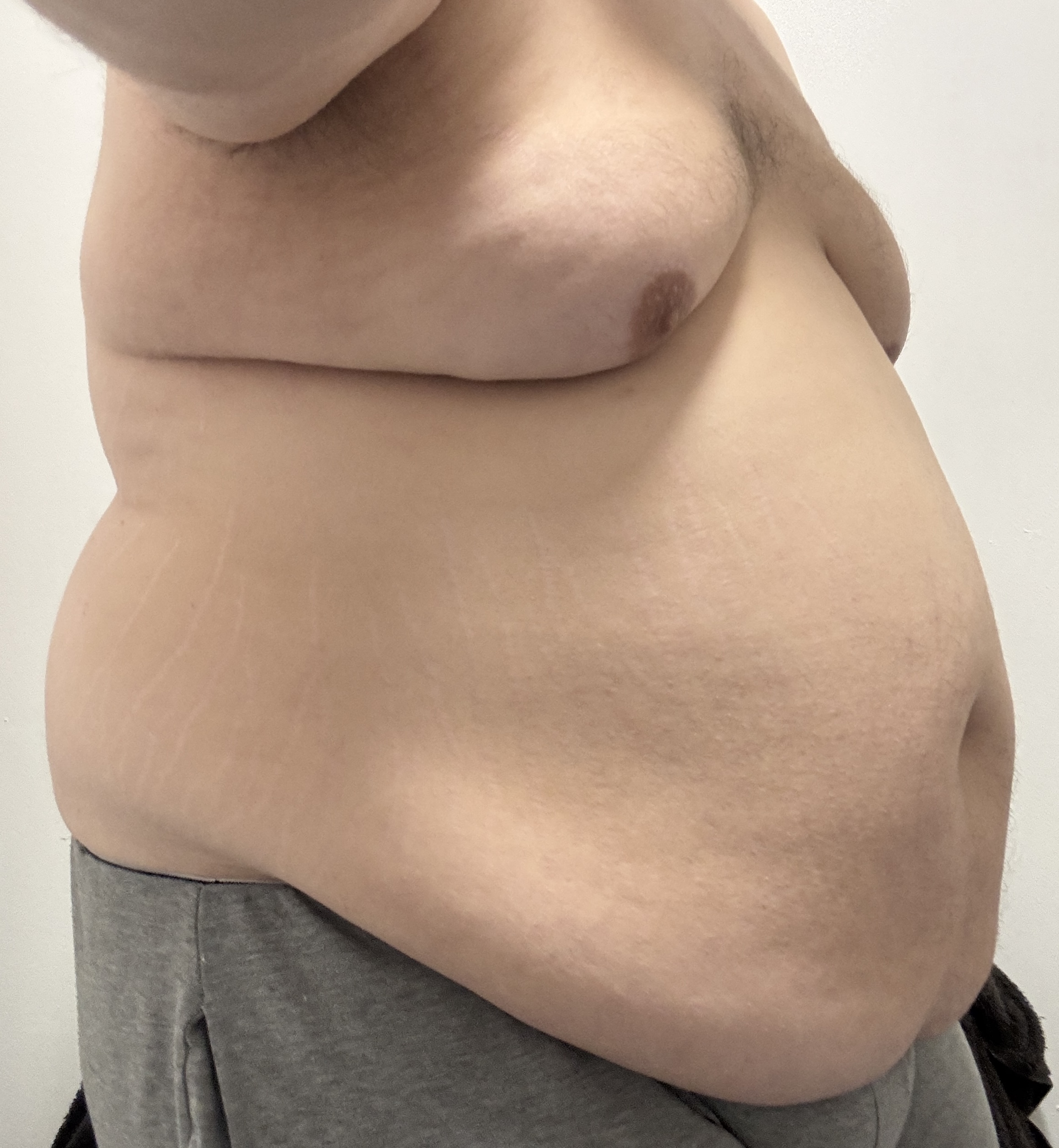 Can I become the obesity meme around here?