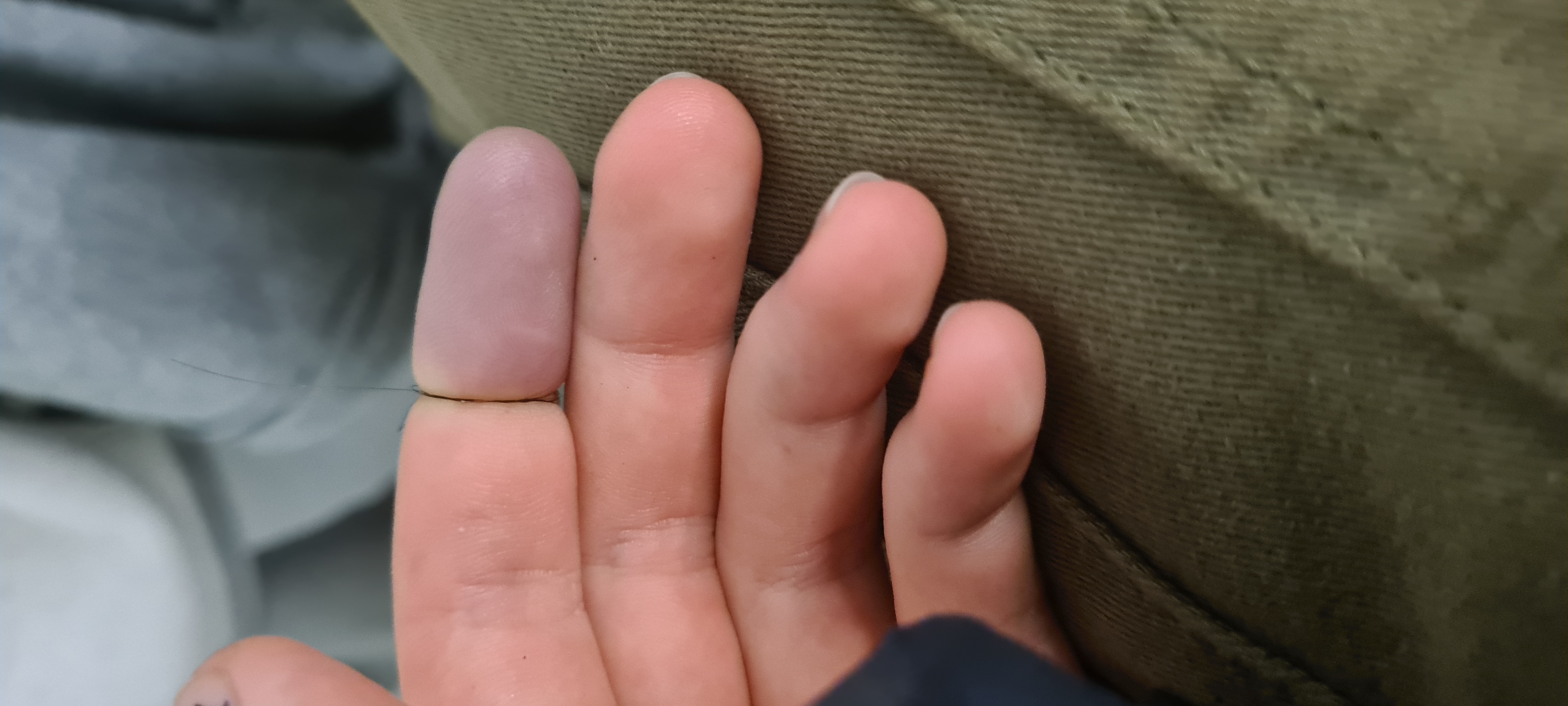 Trying to amputate my finger day1